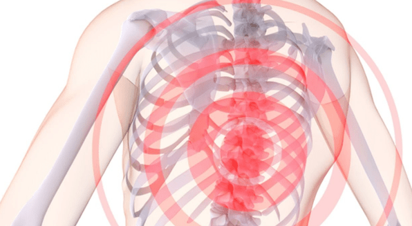 zafi a cikin kashin baya tare da thoracic osteochondrosis