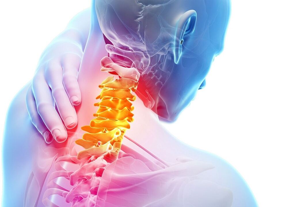 osteochondrosis na cervical kashin baya